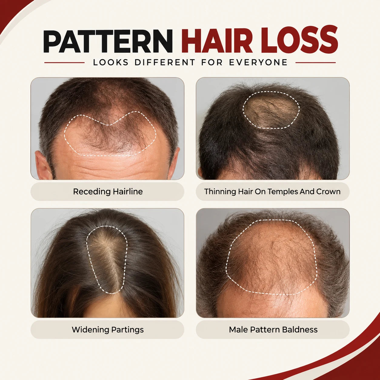 1 in 3 adults live with hair loss.